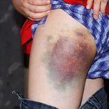 45603_104844252909626_1082425_n_104844252909626